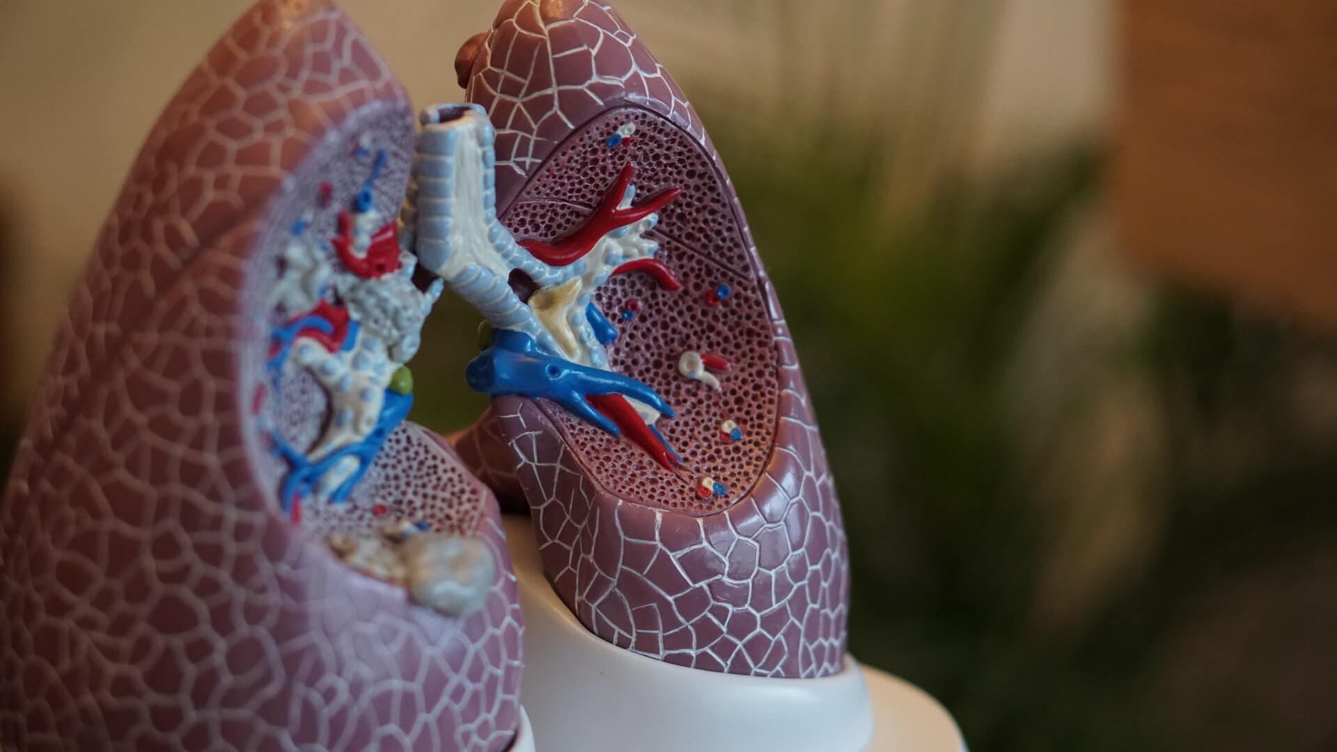 You are currently viewing 폐에 물이차면 증상 및 원인 무엇인가?